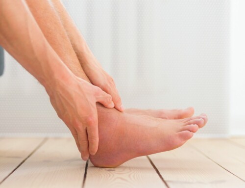 How to deal with swollen ankles?
